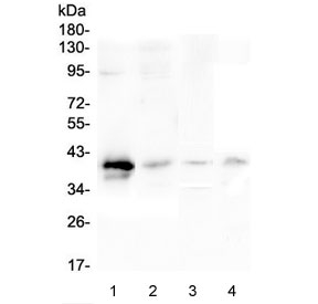 RP2 Antibody - Western blot testing of 1) human placenta, 2) human SGC-7901, 3) rat lung and 4) mouse lung lysate with RP2 antibody at 0.5ug/ml. Predicted molecular weight ~40 kDa.