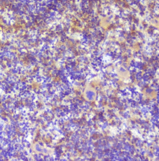 RP2 Antibody - IHC staining of FFPE rat spleen with RP2 antibody at 1ug/ml. HIER: boil tissue sections in pH6, 10mM citrate buffer, for 10-20 min followed by cooling at RT for 20 min.