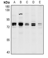 RP49 / CNG1 Antibody - Western blot analysis of CNGA1 expression in CT26 (A), PC12 (B), A549 (C), MCF7 (D), LO2 (E) whole cell lysates.