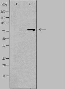 RP49 / CNG1 Antibody - Western blot analysis of extracts of HepG2 cells using CNGA1 antibody. The lane on the left is treated with the antigen-specific peptide.