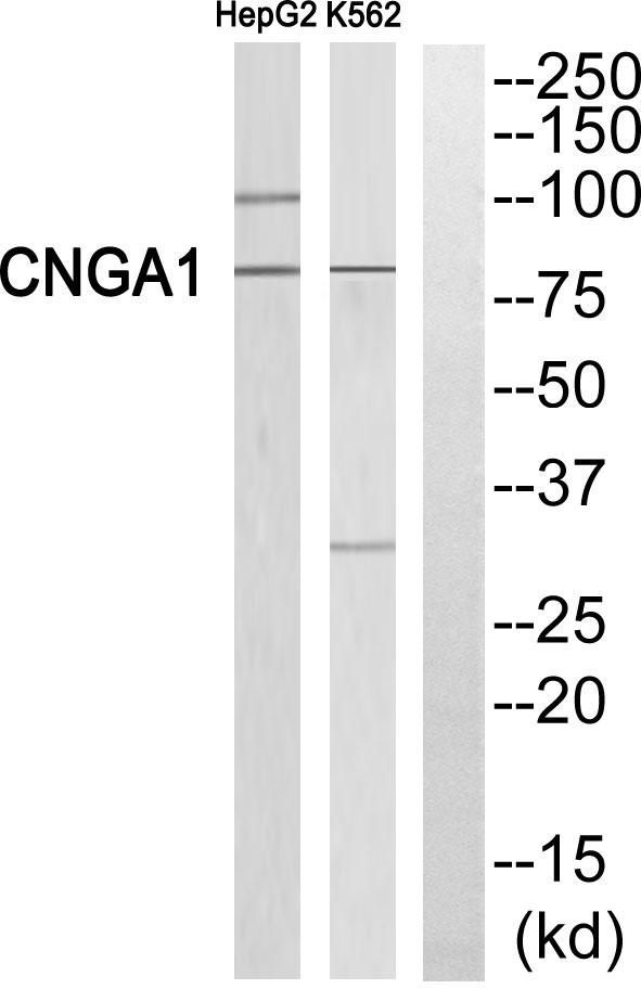 RP49 / CNG1 Antibody - Western blot analysis of extracts from HepG2 cells and K562 cells, using CNGA1 antibody.