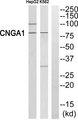 RP49 / CNG1 Antibody - Western blot analysis of extracts from HepG2 cells and K562 cells, using CNGA1 antibody.