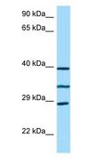RP9 Antibody - RP9 antibody Western Blot of RPMI-8226.  This image was taken for the unconjugated form of this product. Other forms have not been tested.