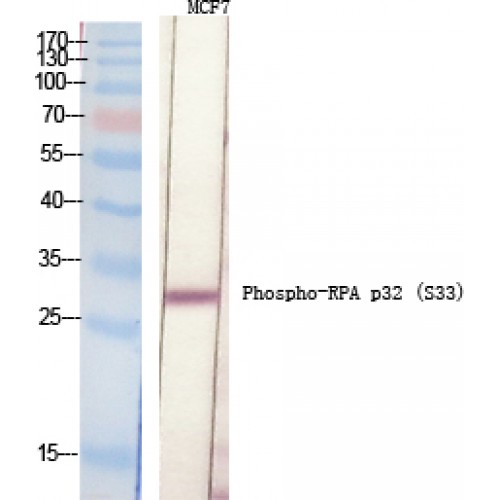RPA2 / RFA2 / RPA34 Antibody - Western blot of Phospho-RPA p32 (S33) antibody