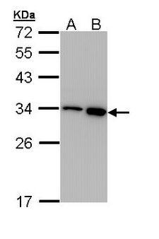 RPA2 / RFA2 / RPA34 Antibody - Sample (30 ug of whole cell lysate). A:293T, B: A431 . 12% SDS PAGE. RPA2 / RPA34 antibody diluted at 1:1000.