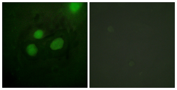 RPA2 / RFA2 / RPA34 Antibody - Immunofluorescence analysis of HeLa cells, using RFA2 Antibody. The picture on the right is blocked with the synthesized peptide.