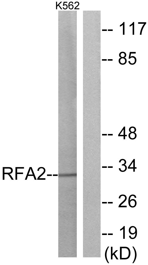 RPA2 / RFA2 / RPA34 Antibody - Western blot analysis of lysates from K562 cells, using RFA2 Antibody. The lane on the right is blocked with the synthesized peptide.