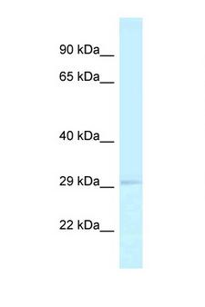 RPA2 / RFA2 / RPA34 Antibody - RPA2 antibody Western blot of Fetal Brain lysate. Antibody concentration 1 ug/ml.  This image was taken for the unconjugated form of this product. Other forms have not been tested.