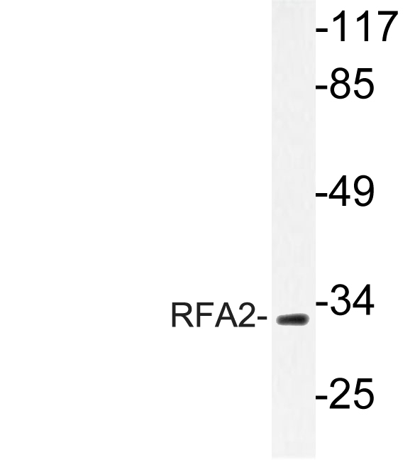 RPA2 / RFA2 / RPA34 Antibody - Western blot of RFA2 (A17) pAb in extracts from HepG2 cells.