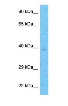 RPA2 / RFA2 / RPA34 Antibody - Western blot of RPA2 Antibody with human MCF7 Whole Cell lysate.  This image was taken for the unconjugated form of this product. Other forms have not been tested.