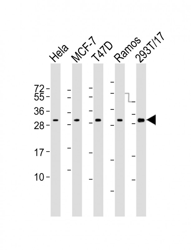 RPA2 / RFA2 / RPA34 Antibody - All lanes: Anti-RFA2 Antibody at 1:4000 dilution. Lane 1: HeLa whole cell lysate. Lane 2: MCF-7 whole cell lysate. Lane 3: T47D whole cell lysate. Lane 4: Ramos whole cell lysate. Lane 5: 293T/17 whole cell lysate Lysates/proteins at 20 ug per lane. Secondary Goat Anti-mouse IgG, (H+L), Peroxidase conjugated at 1:10000 dilution. Predicted band size: 29 kDa. Blocking/Dilution buffer: 5% NFDM/TBST.