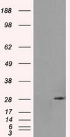 RPA2 / RFA2 / RPA34 Antibody - HEK293T cells were transfected with the pCMV6-ENTRY control (Left lane) or pCMV6-ENTRY RPA2 (Right lane) cDNA for 48 hrs and lysed. Equivalent amounts of cell lysates (5 ug per lane) were separated by SDS-PAGE and immunoblotted with anti-RPA2.