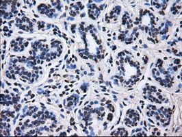 RPA2 / RFA2 / RPA34 Antibody - IHC of paraffin-embedded breast tissue using anti-RPA2 mouse monoclonal antibody. (Dilution 1:50).