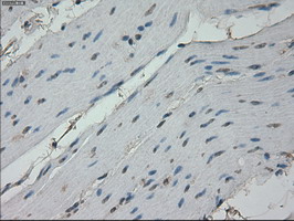 RPA2 / RFA2 / RPA34 Antibody - IHC of paraffin-embedded colon tissue using anti-RPA2 mouse monoclonal antibody. (Dilution 1:50).