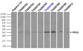 RPA2 / RFA2 / RPA34 Antibody - Immunoprecipitation(IP) of RPA2 by using monoclonal anti-RPA2 antibodies (Negative control: IP without adding anti-RPA2 antibody.). For each experiment, 500ul of DDK tagged RPA2 overexpression lysates (at 1:5 dilution with HEK293T lysate), 2 ug of anti-RPA2 antibody and 20ul (0.1 mg) of goat anti-mouse conjugated magnetic beads were mixed and incubated overnight. After extensive wash to remove any non-specific binding, the immuno-precipitated products were analyzed with rabbit anti-DDK polyclonal antibody.