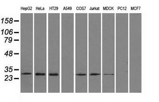RPA2 / RFA2 / RPA34 Antibody - Western blot of extracts (35 ug) from 9 different cell lines by using anti-RPA2 monoclonal antibody.