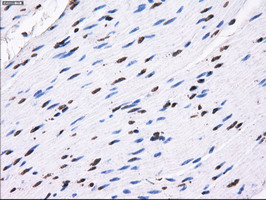 RPA2 / RFA2 / RPA34 Antibody - IHC of paraffin-embedded colon tissue using anti-RPA2 mouse monoclonal antibody. (Dilution 1:50).