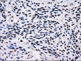 RPA2 / RFA2 / RPA34 Antibody - IHC of paraffin-embedded endometrium tissue using anti-RPA2 mouse monoclonal antibody. (Dilution 1:50).