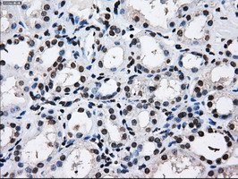 RPA2 / RFA2 / RPA34 Antibody - IHC of paraffin-embedded Kidney tissue using anti-RPA2 mouse monoclonal antibody. (Dilution 1:50).