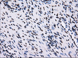 RPA2 / RFA2 / RPA34 Antibody - IHC of paraffin-embedded Ovary tissue using anti-RPA2 mouse monoclonal antibody. (Dilution 1:50).