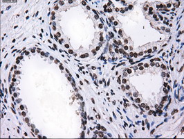 RPA2 / RFA2 / RPA34 Antibody - IHC of paraffin-embedded prostate tissue using anti-RPA2 mouse monoclonal antibody. (Dilution 1:50).