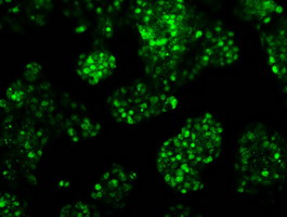 RPA2 / RFA2 / RPA34 Antibody - Immunofluorescent staining of HepG2 cells using anti-RPA2 mouse monoclonal antibody.