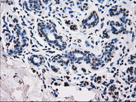 RPA2 / RFA2 / RPA34 Antibody - IHC of paraffin-embedded breast tissue using anti-RPA2 mouse monoclonal antibody. (Dilution 1:50).