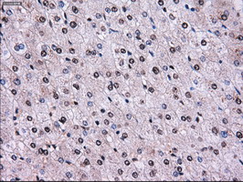 RPA2 / RFA2 / RPA34 Antibody - IHC of paraffin-embedded liver tissue using anti-RPA2 mouse monoclonal antibody. (Dilution 1:50).