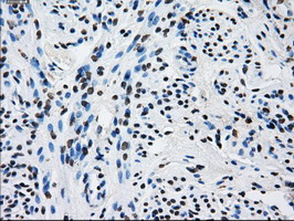 RPA2 / RFA2 / RPA34 Antibody - IHC of paraffin-embedded endometrium tissue using anti-RPA2 mouse monoclonal antibody. (Dilution 1:50).