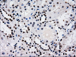 RPA2 / RFA2 / RPA34 Antibody - IHC of paraffin-embedded Kidney tissue using anti-RPA2 mouse monoclonal antibody. (Dilution 1:50).