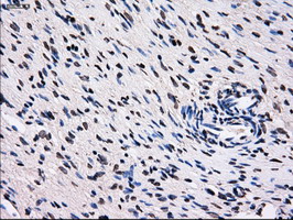 RPA2 / RFA2 / RPA34 Antibody - IHC of paraffin-embedded Ovary tissue using anti-RPA2 mouse monoclonal antibody. (Dilution 1:50).
