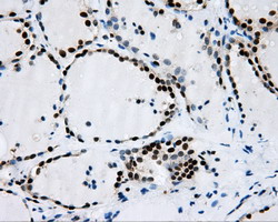 RPA2 / RFA2 / RPA34 Antibody - IHC of paraffin-embedded thyroid tissue using anti-RPA2 mouse monoclonal antibody. (Dilution 1:50).