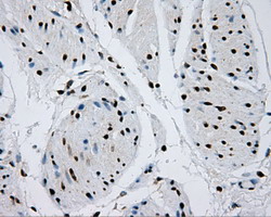 RPA2 / RFA2 / RPA34 Antibody - IHC of paraffin-embedded bladder tissue using anti-RPA2 mouse monoclonal antibody. (Dilution 1:50).