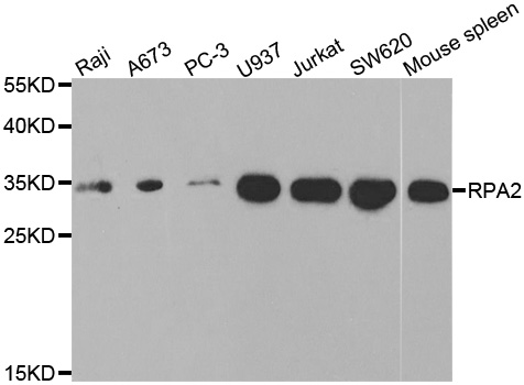 RPA2 / RFA2 / RPA34 Antibody - Western blot analysis of extracts of various cell lines.