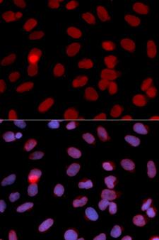RPA2 / RFA2 / RPA34 Antibody - Immunofluorescence analysis of U2OS cells.