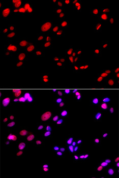 RPA2 / RFA2 / RPA34 Antibody - Immunofluorescence analysis of GFP-RNF168 trangenic U2OS cells.