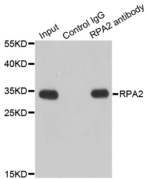 RPA2 / RFA2 / RPA34 Antibody - Immunoprecipitation analysis of 200ug extracts of Jurkat cells.