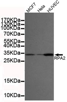 RPA2 / RFA2 / RPA34 Antibody - Western blot detection of RPA32/RPA2 in MCF7, HeLa and HUVEC cell lysates using RPA32/RPA2 mouse monoclonal antibody (1:2000 dilution). Predicted band size: 32KDa. Observed band size:32KDa.Exposure time:20s.