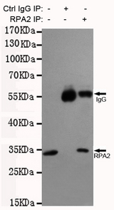 RPA2 / RFA2 / RPA34 Antibody - Immunoprecipitation analysis of HeLa cell lysates using RPA32/RPA2 mouse monoclonal antibody.