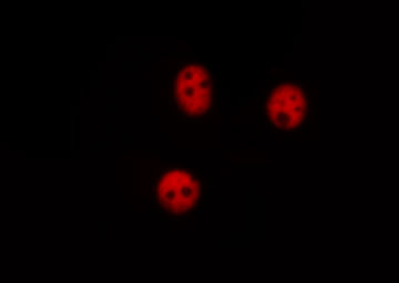 RPA2 / RFA2 / RPA34 Antibody - Staining A549 cells by IF/ICC. The samples were fixed with PFA and permeabilized in 0.1% saponin prior to blocking in 10% serum for 45 min at 37°C. The primary antibody was diluted 1/400 and incubated with the sample for 1 hour at 37°C. A Alexa Fluor® 594 conjugated goat polyclonal to rabbit IgG (H+L), diluted 1/600 was used as secondary antibody.