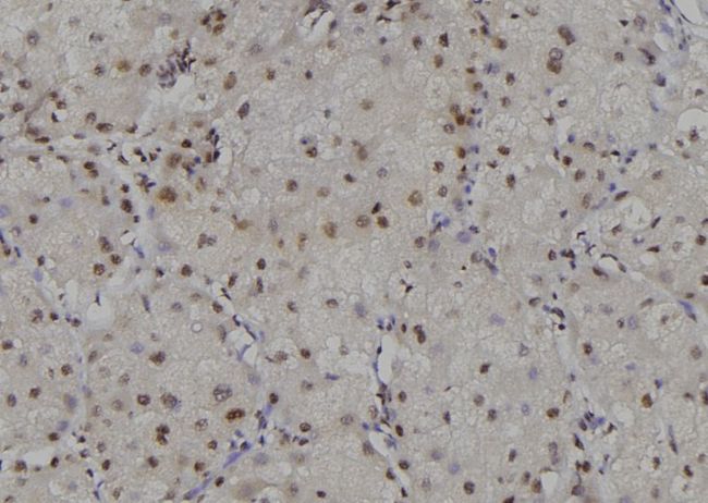 RPA2 / RFA2 / RPA34 Antibody - 1:100 staining human liver tissue by IHC-P. The sample was formaldehyde fixed and a heat mediated antigen retrieval step in citrate buffer was performed. The sample was then blocked and incubated with the antibody for 1.5 hours at 22°C. An HRP conjugated goat anti-rabbit antibody was used as the secondary.