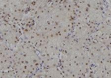 RPA2 / RFA2 / RPA34 Antibody - 1:100 staining human liver tissue by IHC-P. The sample was formaldehyde fixed and a heat mediated antigen retrieval step in citrate buffer was performed. The sample was then blocked and incubated with the antibody for 1.5 hours at 22°C. An HRP conjugated goat anti-rabbit antibody was used as the secondary.