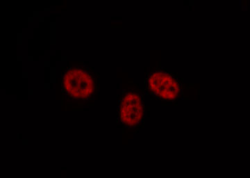 RPA2 / RFA2 / RPA34 Antibody - Staining HeLa cells by IF/ICC. The samples were fixed with PFA and permeabilized in 0.1% Triton X-100, then blocked in 10% serum for 45 min at 25°C. The primary antibody was diluted at 1:200 and incubated with the sample for 1 hour at 37°C. An Alexa Fluor 594 conjugated goat anti-rabbit IgG (H+L) Ab, diluted at 1/600, was used as the secondary antibody.
