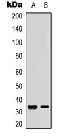 RPA2 / RFA2 / RPA34 Antibody - Western blot analysis of RPA2 (pS33) expression in MCF7 (A); NIH3T3 (B) whole cell lysates.