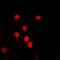 RPA2 / RFA2 / RPA34 Antibody - Immunofluorescent analysis of RPA2 (pT21) staining in HeLa cells. Formalin-fixed cells were permeabilized with 0.1% Triton X-100 in TBS for 5-10 minutes and blocked with 3% BSA-PBS for 30 minutes at room temperature. Cells were probed with the primary antibody in 3% BSA-PBS and incubated overnight at 4 deg C in a humidified chamber. Cells were washed with PBST and incubated with a DyLight 594-conjugated secondary antibody (red) in PBS at room temperature in the dark. DAPI was used to stain the cell nuclei (blue).