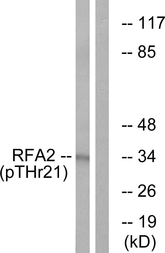 RPA2 / RFA2 / RPA34 Antibody - Western blot analysis of lysates from HeLa cells treated with Adriamycin 0.5ug/ml 24h, using RFA2 (Phospho-Thr21) Antibody. The lane on the right is blocked with the phospho peptide.