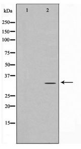 RPA2 / RFA2 / RPA34 Antibody - Western blot of RFA2 phosphorylation expression in Adriamycin treated HeLa whole cell lysates,The lane on the left is treated with the antigen-specific peptide.