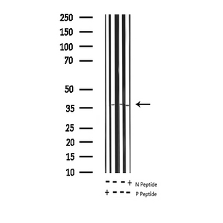 RPA2 / RFA2 / RPA34 Antibody - Western blot analysis of Phospho-RFA2 (Thr21) expression in various lysates