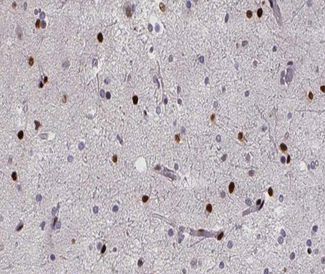 RPA2 / RFA2 / RPA34 Antibody - 1:200 staining human brain tissue by IHC-P. The tissue was formaldehyde fixed and a heat mediated antigen retrieval step in citrate buffer was performed. The tissue was then blocked and incubated with the antibody for 1.5 hours at 22°C. An HRP conjugated goat anti-rabbit antibody was used as the secondary.