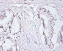 RPA3 Antibody - Immunohistochemistry of paraffin-embedded human prostate tissue using RPA3 Antibody at dilution of 1:100